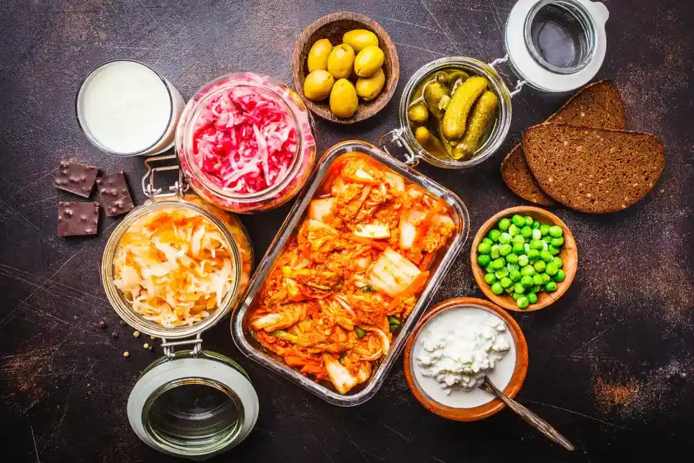 Assorted probiotic-rich foods including kimchi, sauerkraut, yogurt, pickles, and fermented vegetables on a dark kitchen surface.